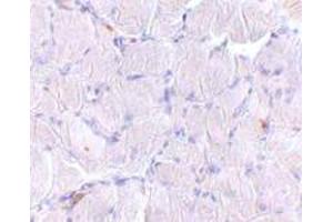 Immunohistochemical staining of human skeletal muscle tissue with 10 ug/mL SCARB2 polyclonal antibody . (SCARB2 antibody  (C-Term))