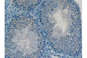 DAB staining on IHC-P; Samples: Mouse Testis Tissue (C2CD3 antibody  (AA 2051-2323))