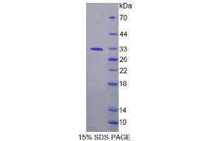 SDS-PAGE analysis of Human FPGT Protein.