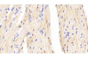 Detection of b2M in Mouse Cardiac Muscle Tissue using Polyclonal Antibody to Beta-2-Microglobulin (b2M) (beta-2 Microglobulin antibody  (AA 22-119))