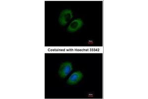 ICC/IF Image Immunofluorescence analysis of methanol-fixed A549, using CACNA1B, antibody at 1:500 dilution. (CACNA1B antibody  (C-Term))