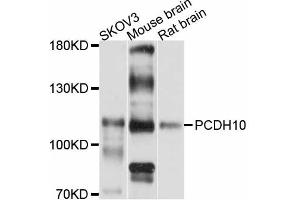 Western blot analysis of extracts of various cell lines, using PCDH10 antibody (ABIN5998466) at 1:3000 dilution. (PCDH10 antibody)
