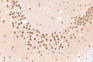 Immunohistochemistry analysis of paraffin-embedded mouse cerebral infarction using BAAT1 (ABIN7073502) at dilution of 1: 1000 (BAAT1 antibody)