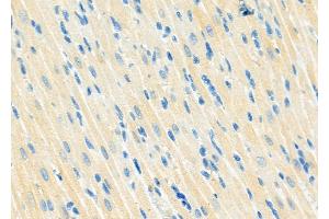 ABIN6263352 and ABIN6273268 at 1/100 staining Rat heart tissue by IHC-P. (MRFAP1 antibody  (Internal Region))