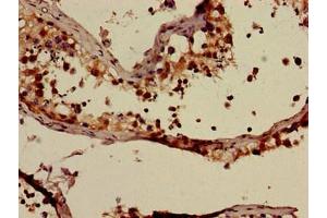 Immunohistochemistry of paraffin-embedded human testis tissue using ABIN7144908 at dilution of 1:100