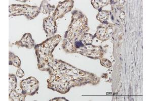 Immunoperoxidase of purified MaxPab antibody to SNX1 on formalin-fixed paraffin-embedded human placenta. (Sorting Nexin 1 antibody  (AA 1-522))