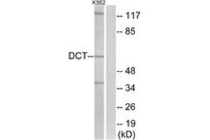 Western blot analysis of extracts from K562 cells, using DCT Antibody. (DCT antibody  (AA 51-100))
