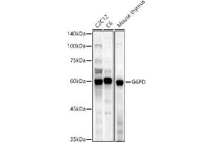 Western blot analysis of extracts of various cell lines, using G6PD antibody (ABIN3022094, ABIN3022095, ABIN3022096 and ABIN6218601) at 1:1000 dilution. (Glucose-6-Phosphate Dehydrogenase antibody  (AA 246-545))