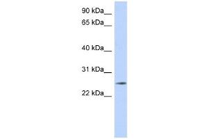 NKAIN4 antibody used at 1 ug/ml to detect target protein. (NKAIN4 antibody  (Middle Region))