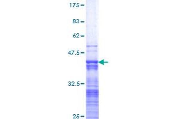 KLF11 Protein (AA 404-512) (GST tag)