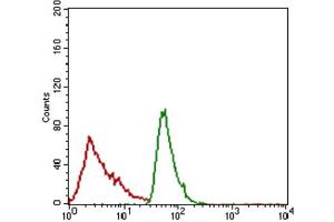 Immunohistochemical analysis of paraffin-embedded bladder cancer tissues using ALCAM antibody with DAB staining. (CD166 antibody  (AA 48-216))
