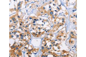 Immunohistochemistry (IHC) image for anti-Capping Protein (Actin Filament) Muscle Z-Line, alpha 3 (CAPZA3) antibody (ABIN2825233) (CAPZA3 antibody)