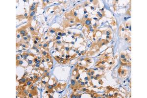 Immunohistochemistry (IHC) image for anti-Capping Protein (Actin Filament) Muscle Z-Line, alpha 3 (CAPZA3) antibody (ABIN5544205)