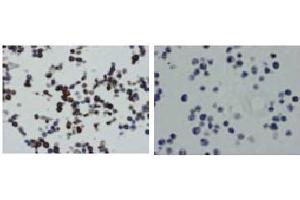 Immunohistochemistry (IHC) image for anti-Tumor Necrosis Factor (Ligand) Superfamily, Member 13b (TNFSF13B) antibody (ABIN1449224) (BAFF antibody)