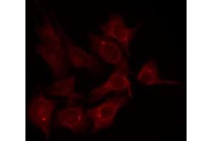 ABIN6274713 staining K562 by IF/ICC. (AGPAT3 antibody  (Internal Region))