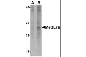 Western blot analysis of MettL7B in Jurkat lysate with this product at (A) 2 and (B) 4 μg/ml.
