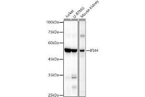 Western blot analysis of extracts of various cell lines, using IFI44 antibody (ABIN6135120, ABIN6142168, ABIN6142169 and ABIN6224213) at 1:1000 dilution. (IFI44 antibody)