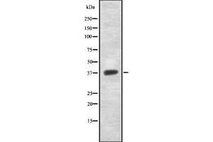 NDUFAF1 antibody  (N-Term)