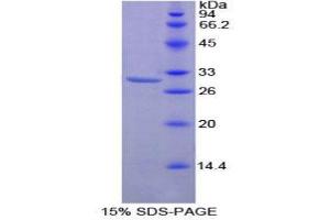 SDS-PAGE (SDS) image for Protein Kinase C, zeta (PRKCZ) (AA 254-484) protein (His tag) (ABIN1879241) (PKC zeta Protein (AA 254-484) (His tag))