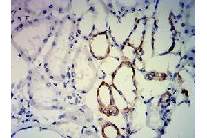 Immunohistochemical analysis of paraffin-embedded kidney tissues using ERCC1 mouse mAb with DAB staining. (ERCC1 antibody  (AA 1-297))