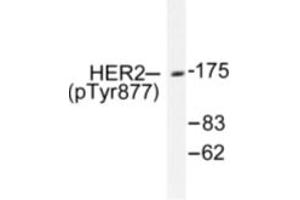 Image no. 1 for anti-Receptor tyrosine-protein kinase erbB-2 (ErbB2/Her2) (pTyr877) antibody (ABIN318038) (ErbB2/Her2 antibody  (pTyr877))