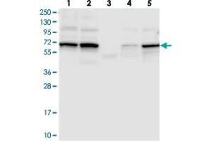 Western blot analysis of Lane 1: RT-4, Lane 2: U-251 MG, Lane 3: Human Plasma, Lane 4: Liver, Lane 5: Tonsil with TCHP polyclonal antibody  at 1:250-1:500 dilution.
