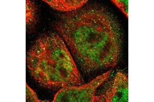 Immunofluorescent staining of A-431 cells with ACSS2 polyclonal antibody  (Green) shows positivity in cytoplasm, vesicles and nucleus but excluded from the nucleoli.