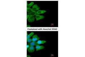ICC/IF Image Immunofluorescence analysis of methanol-fixed A431, using CD32B, antibody at 1:500 dilution.