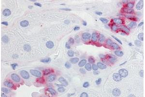 Human Kidney (formalin-fixed, paraffin-embedded) stained with PTGER2 antibody ABIN213470 at 20-40 ug/ml followed by biotinylated goat anti-rabbit IgG secondary antibody ABIN481713, alkaline phosphatase-streptavidin and chromogen. (PTGER2 antibody  (Cytoplasmic Domain))