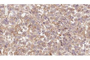 Immunohistochemistry (IHC) image for anti-Hepatocyte Growth Factor Activator (HGFA) (C-Term) antibody (ABIN6262231)