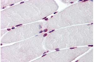 Human Skeletal Muscle: Formalin-Fixed, Paraffin-Embedded (FFPE) (BAZ1B antibody  (AA 1384-1484))