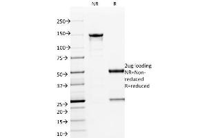 SDS-PAGE Analysis Purified ETS1 Mouse Monoclonal Antibody (ETS1/1801). (ETS1 antibody  (AA 137-230))