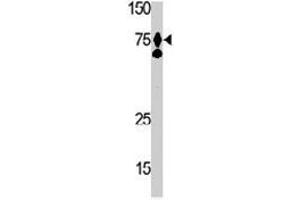 The HGF polyclonal antibody  is used in Western blot to detect HGF in Ramos cell lysate. (HGF antibody  (AA 521-554))