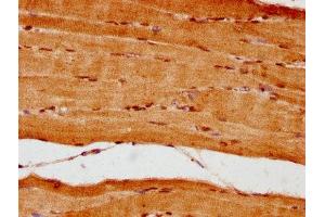 IHC image of ABIN7161836 diluted at 1:300 and staining in paraffin-embedded human skeletal muscle tissue performed on a Leica BondTM system. (NUP62 antibody  (AA 173-522))