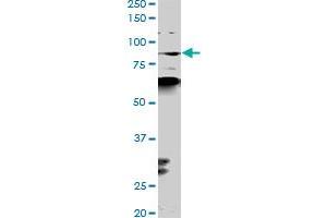 Western Blotting (WB) image for anti-K(lysine) Acetyltransferase 2B (KAT2B) (AA 353-452) antibody (ABIN522304)