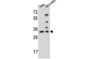 NTHL1 Antibody (Center R103) western blot analysis in Hela,NCI-H460 cell line lysates (35µg/lane). (Nth Endonuclease III-Like 1 (NTHL1) (AA 95-126), (Middle Region) antibody)