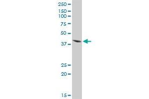 ISL1 MaxPab rabbit polyclonal antibody. (ISL1 antibody  (AA 1-346))