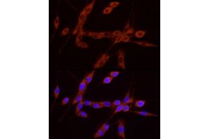 Immunofluorescence analysis of U-87MG cells using GDNF Rabbit pAb (ABIN7267388) at dilution of 1:100 (40x lens). (GDNF antibody  (AA 109-211))