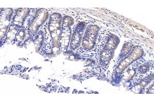 Detection of MT1 in Rat Colon Tissue using Polyclonal Antibody to Metallothionein 1 (MT1) (MT1 antibody  (AA 1-61))