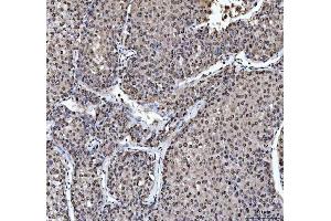 IHC analysis of hnRNP L/HNRNPL using anti-hnRNP L/HNRNPL antibody (ABIN7600130). (HNRNPL antibody  (AA 152-569))