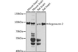 Western blot analysis of extracts of various cell lines, using Argonaute-2 antibody (ABIN6133693, ABIN6140045, ABIN6140047 and ABIN6221669) at 1:1000 dilution. (AGO2 antibody  (AA 1-100))