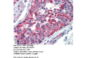 Immunohistochemistry (IHC) image for anti-Lin-28 Homolog A (C. Elegans) (LIN28A) (N-Term) antibody (ABIN2775818)