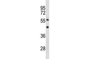 YY1 antibody western blot analysis in MDA-MB453 lysate. (YY1 antibody  (AA 210-239))