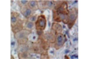 Used in DAB staining on fromalin fixed paraffin-embedded Liver tissue (APOB antibody  (AA 3365-3548))