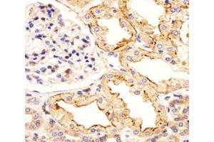 Immunohistochemical analysis of paraffin-embedded human kidney section using ATF6 beta antibody at 1:25. (ATF6B antibody  (AA 560-589))