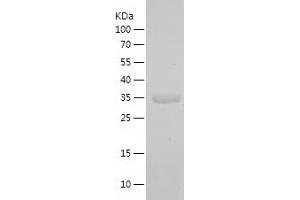 Western Blotting (WB) image for Cytosol Aminopeptidase (LAP3) (AA 252-368) protein (His-IF2DI Tag) (ABIN7122590) (LAP3 Protein (AA 252-368) (His-IF2DI Tag))