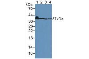 Figure. (CTGF antibody  (AA 248-349))
