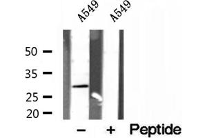 Western blot analysis of extracts of A549 cells, using RAB3D antibody. (RAB3D antibody  (Internal Region))