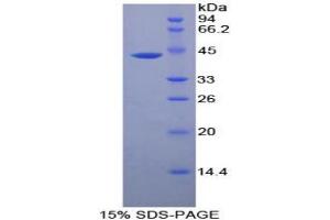 SDS-PAGE analysis of Human CKM Protein. (CKM Protein)