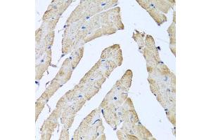 Immunohistochemistry of paraffin-embedded mouse heart using ATAD3B antibody (ABIN5974542) at dilution of 1/100 (40x lens).